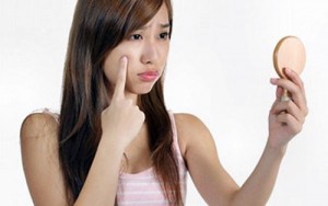 Bạn đã trị mụn đúng cách chưa?