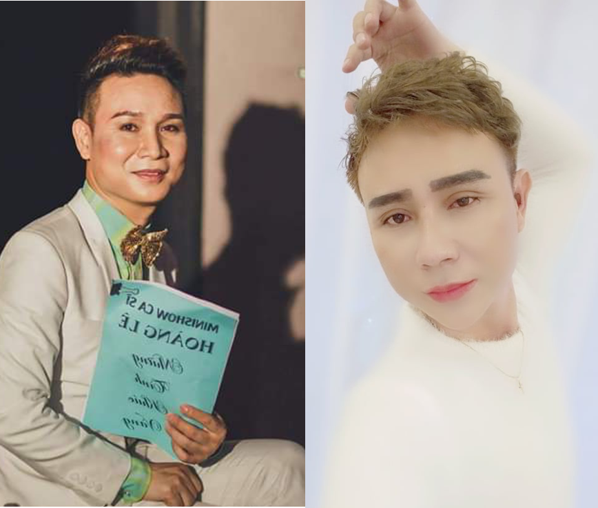 MC Tiến Vĩnh trước và sau khi phẫu thuật thẩm mỹ