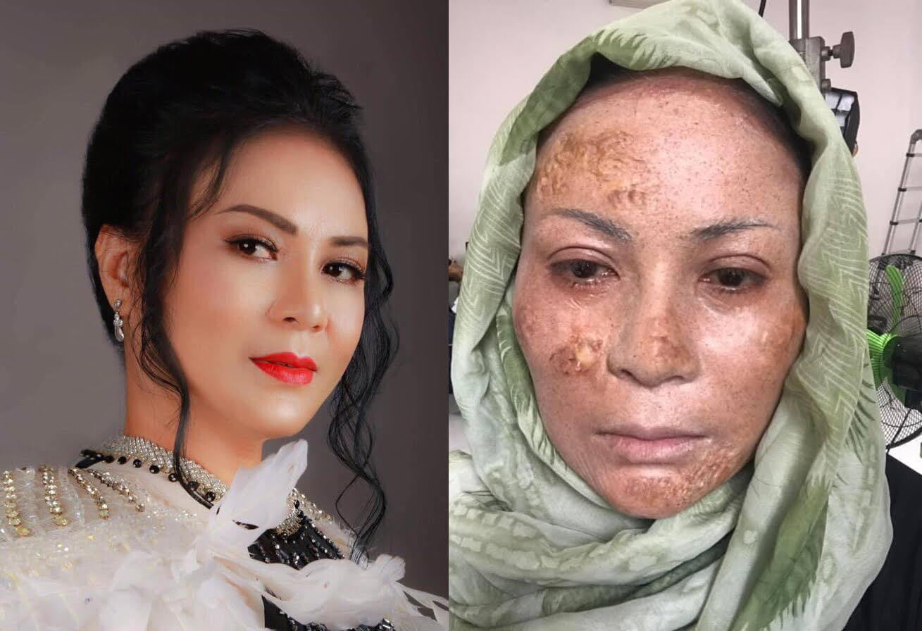 Ôn Bích Hằng không ngại xấu xí trong phim mới