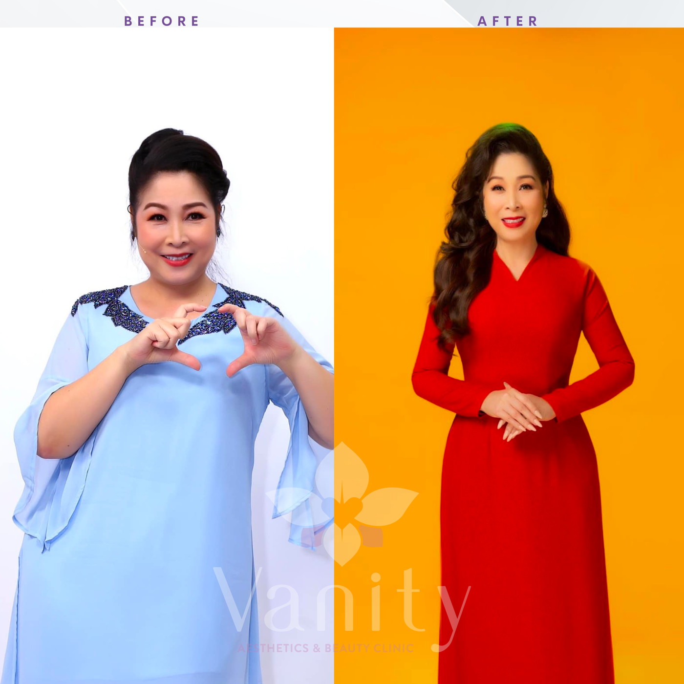 NSND Hồng Vân trước và sau khi giảm cân