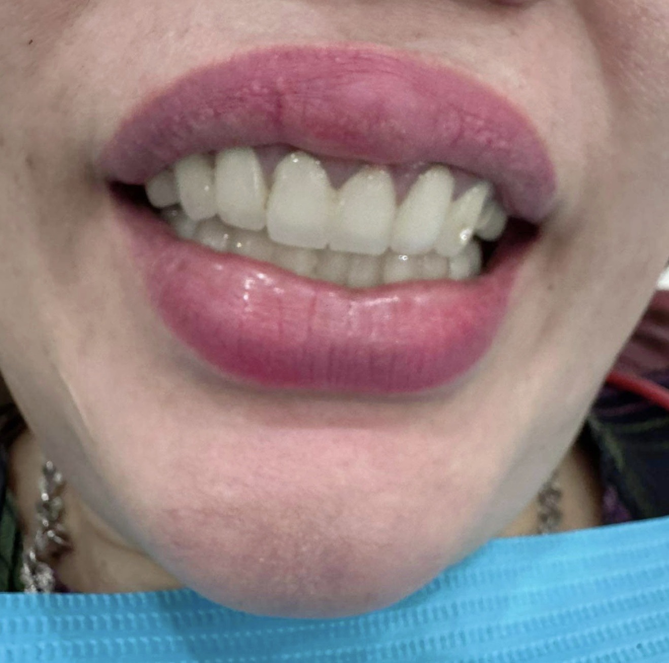 Rang 1