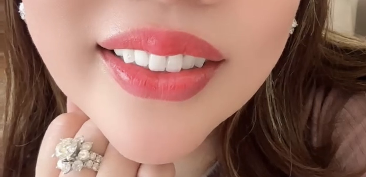 Rang 2